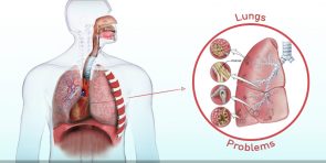 Love Your Lungs? Beware Of The Air You Are Breathing 